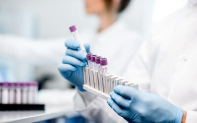 Preventing Rh Alloimmunization